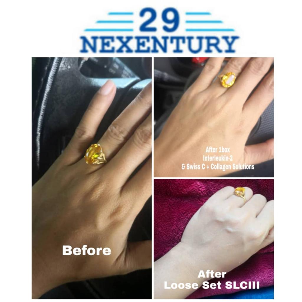 29Nexentury Interleukin-2 + Pyridoxine