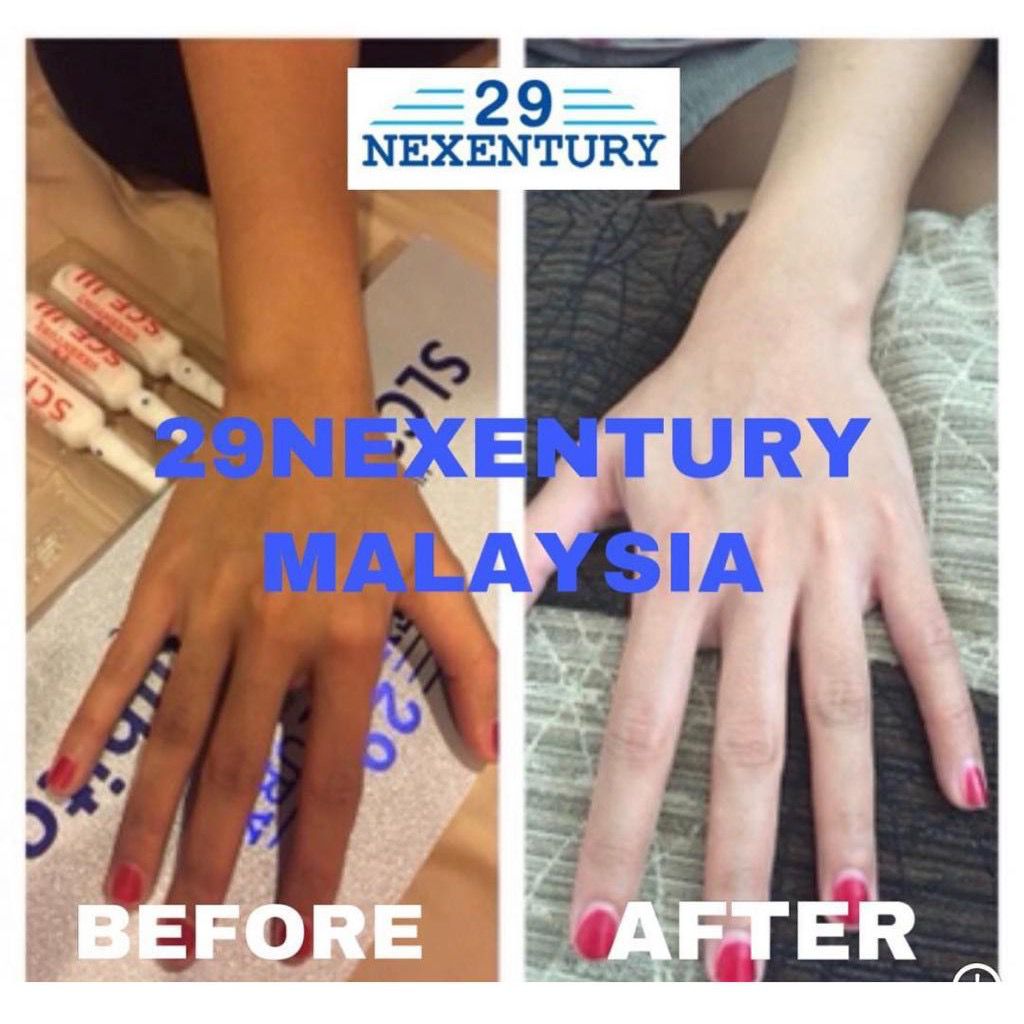 29Nexentury White Cell Solution III