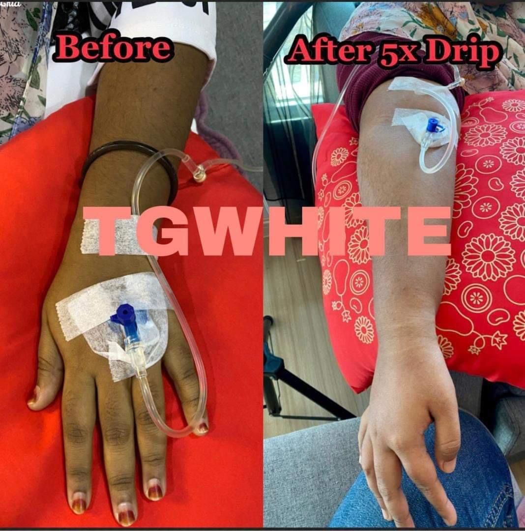 TG White Full Set