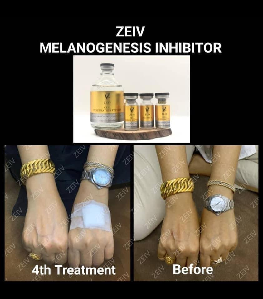 Zeiv Melanogenesis Inhibitor