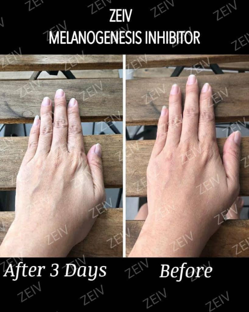 Zeiv Melanogenesis Inhibitor
